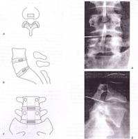 Tecnica discografica